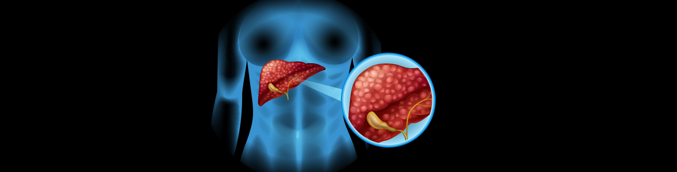 From abdominal pain to loss of appetite: Here are some symptoms that could be linked to gallbladder cancer